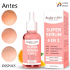 Serum 4 3n 1